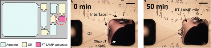 Left. An illustration of a device used for amplification. The labels are aqueous, oil, and R T lamp substrate. Middle and Right. 2 micrographs. Left. Oil, interface, and oligo d t beads are marked. Right. R T-Lamp mix is marked.