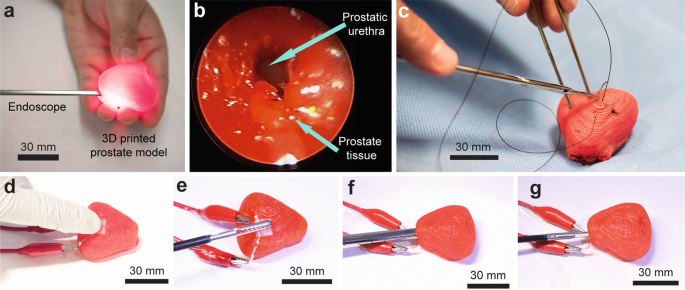 3D-Printed Artificial Organ Models for Surgical Applications | SpringerLink
