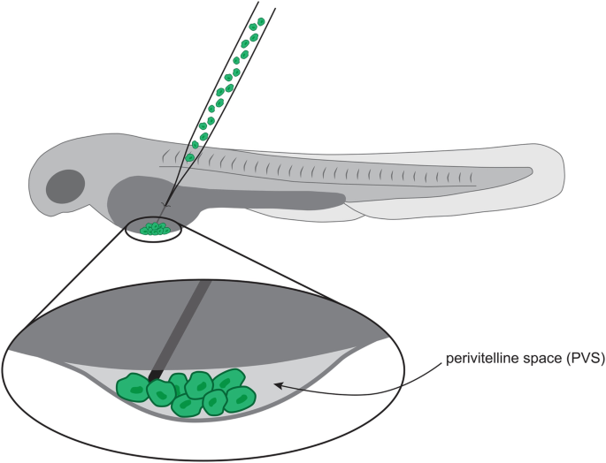 Pvsgb Injection High-Content Imaging-Based Screening for Anticancer Compounds in ...