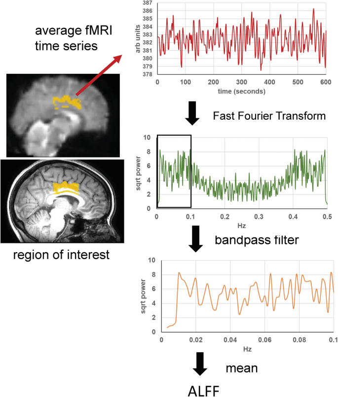 fMRI in Epilepsy | SpringerLink