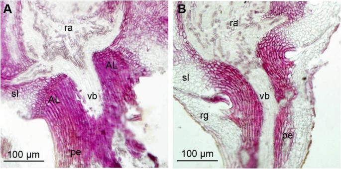Histochemical Assays for Analyzing Abscission Layer Development and ...