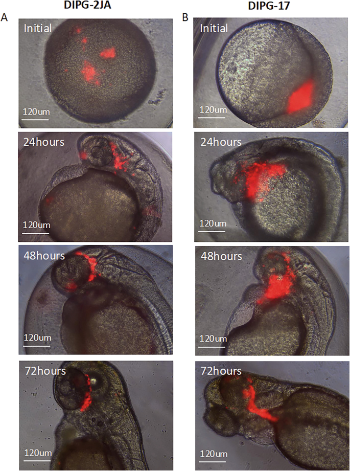 Developing a Zebrafish Xenograft Model of Diffuse Midline Glioma ...