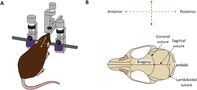 Development of a Gene Therapy with Lentiviral Vectors for ...