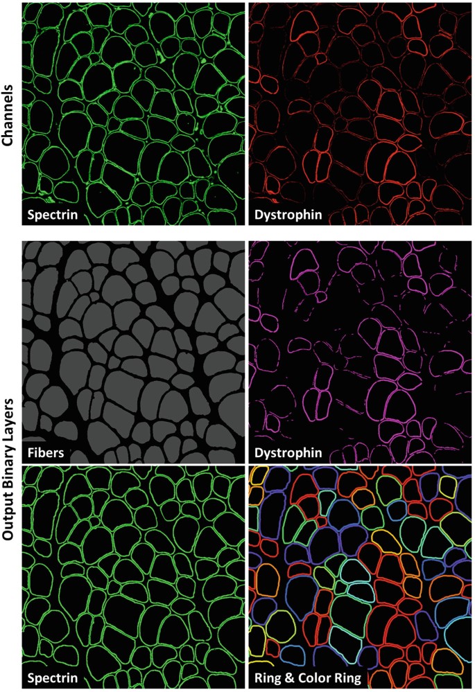 Automated Quantification of Dystrophin Expression by Immunofluorescence ...