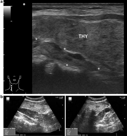 figure 7_18