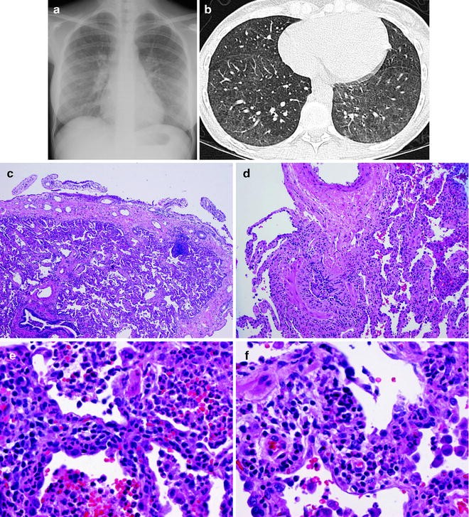 figure 19_8