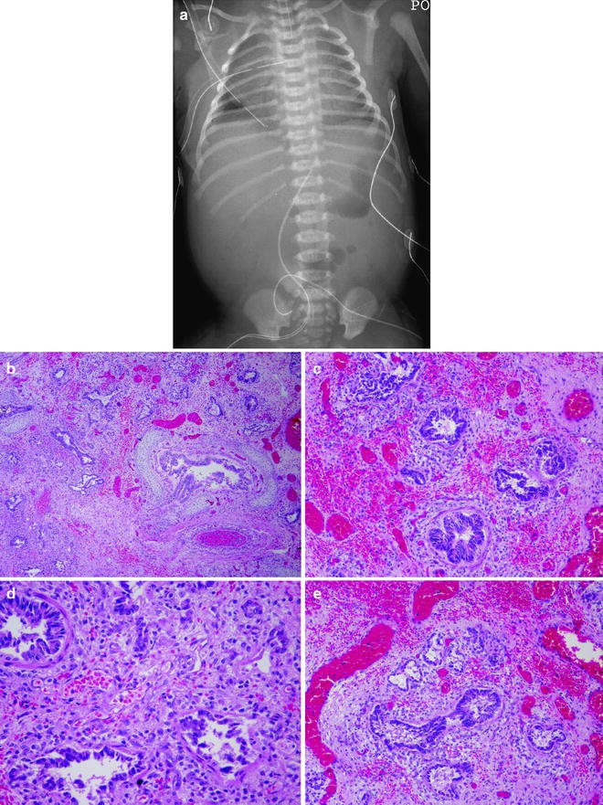 figure 1_8