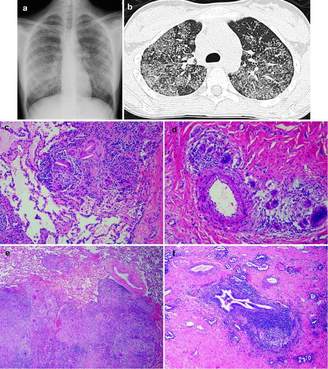 figure 21_8