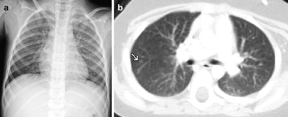 figure 22_8