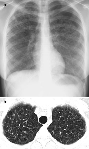 figure 23_8