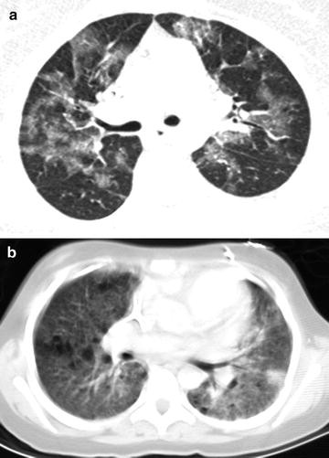 figure 24_8