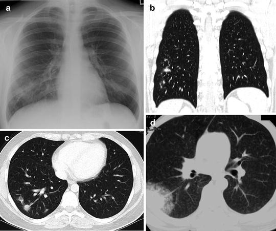 figure 27_8