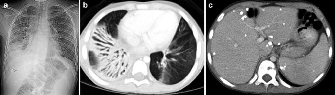 figure 28_8