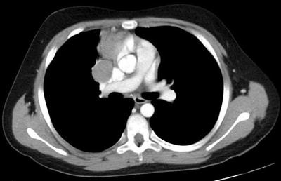 figure 2_41