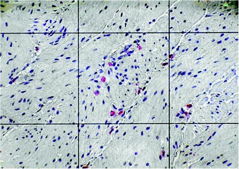 alkaline bpc-157 BPC 157 #crohn #collitisulcerosa #ligament #woundhealing  #gastrointestinalproblems #inflammation