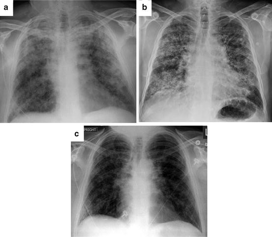 figure 3_4