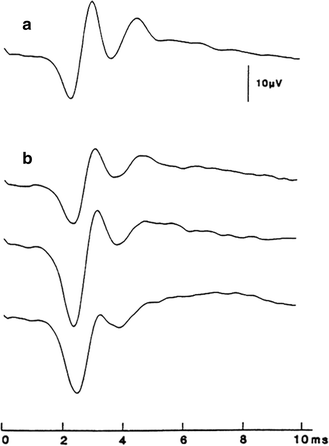 figure 12_7