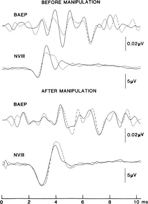 figure 16_7