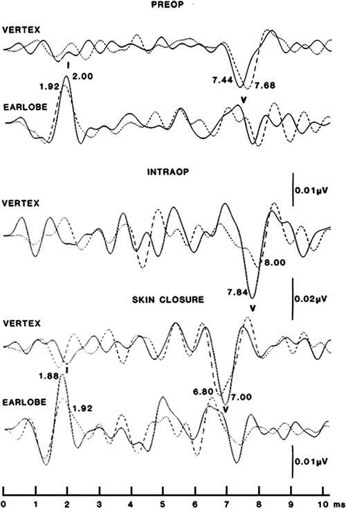 figure 18_7