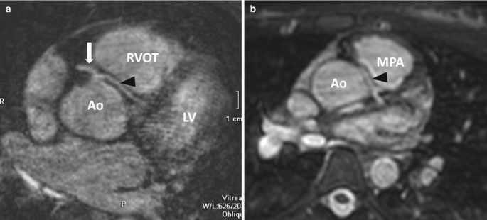 figure 33