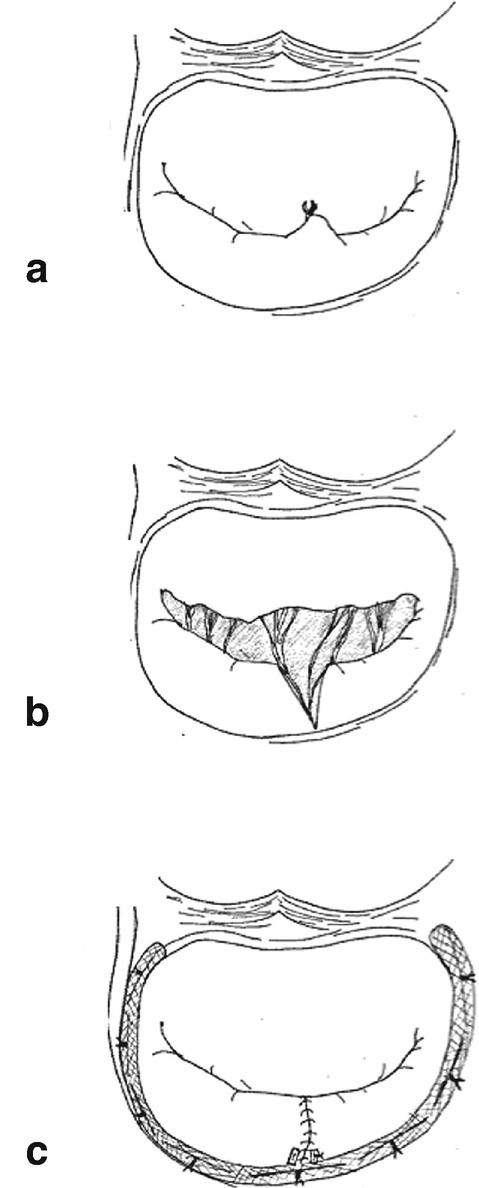 figure 25