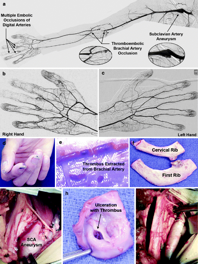 figure 00792