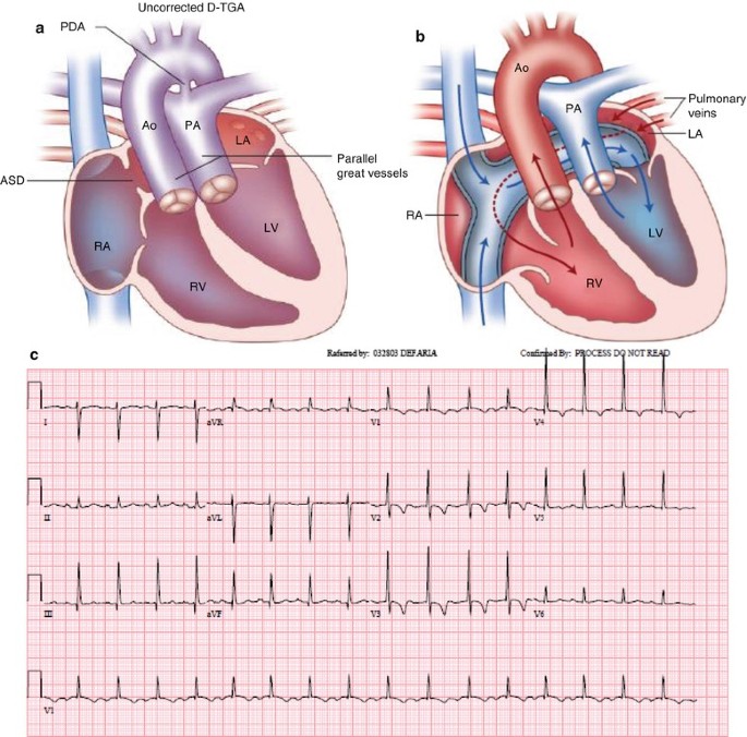 figure 00219