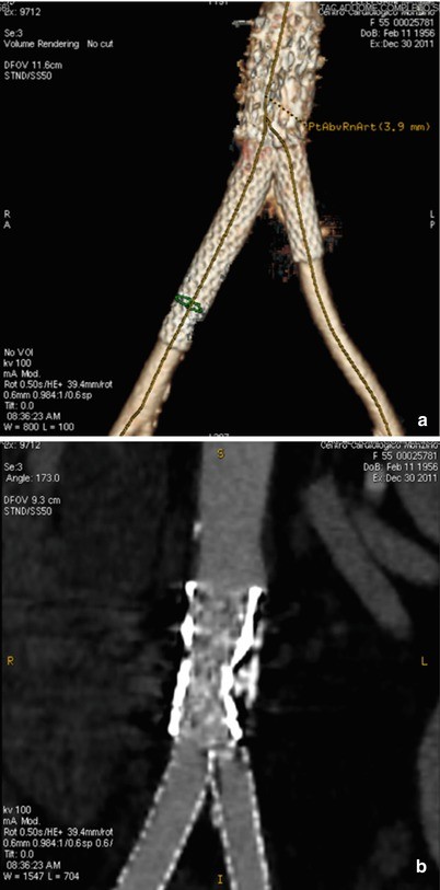 figure 30