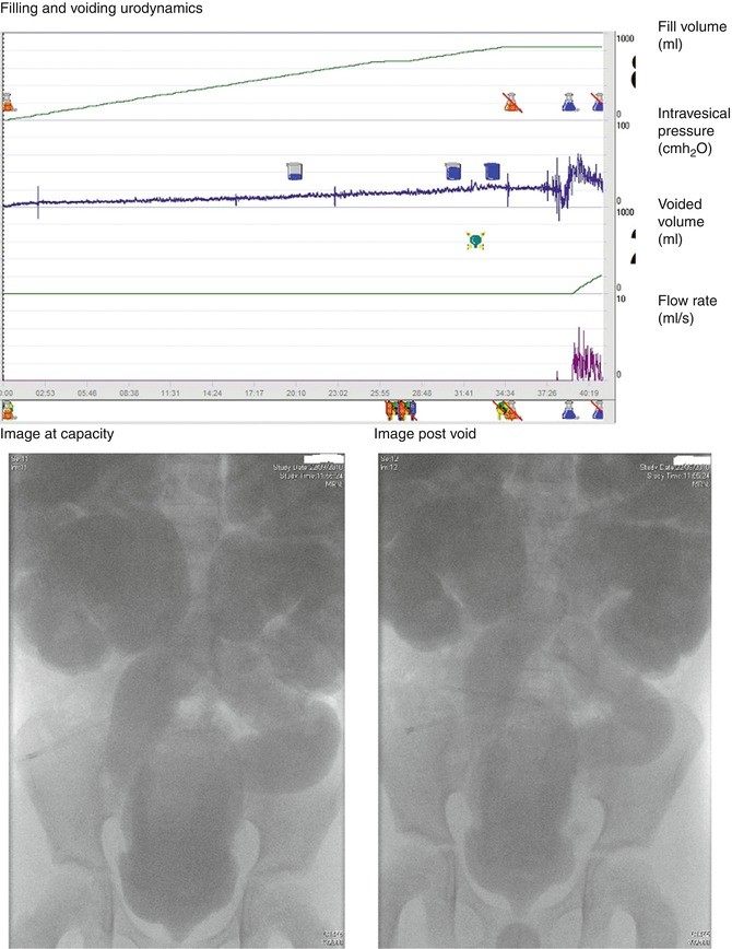 figure 21