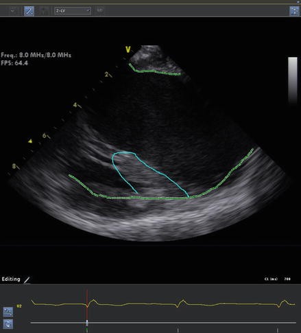 figure 17