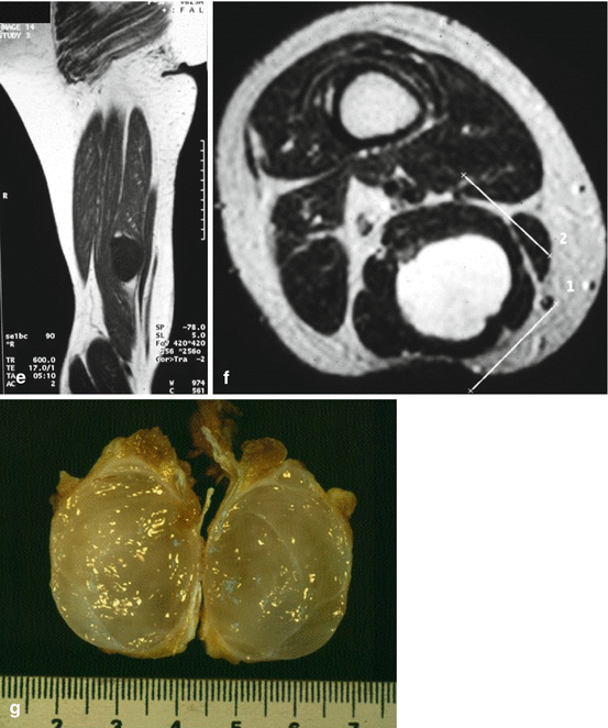 figure 25