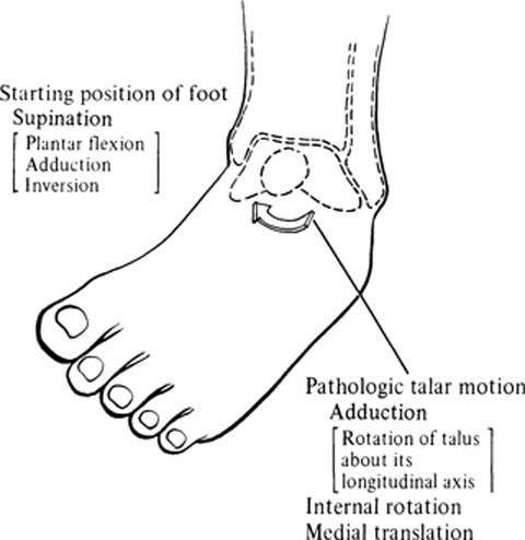 Ankle supination trauma