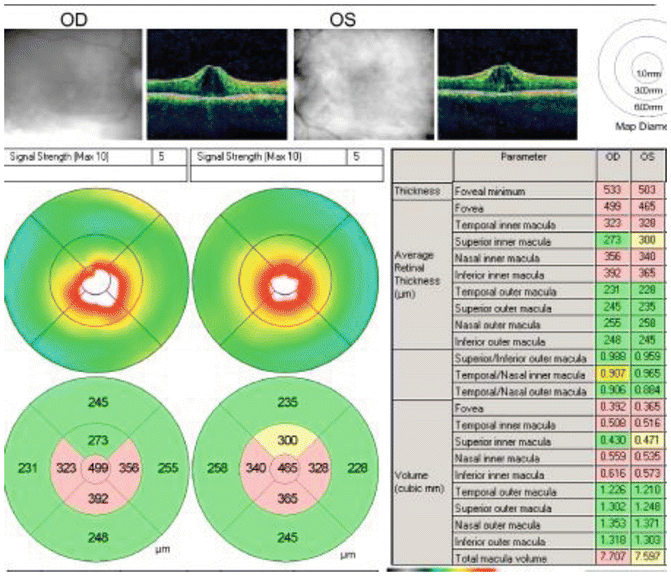 figure 15