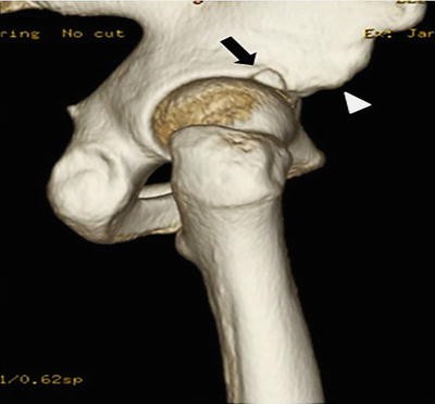 Imaging of Cartilage Patho-anatomy | SpringerLink