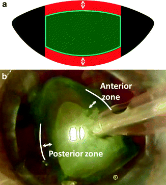 figure 00177