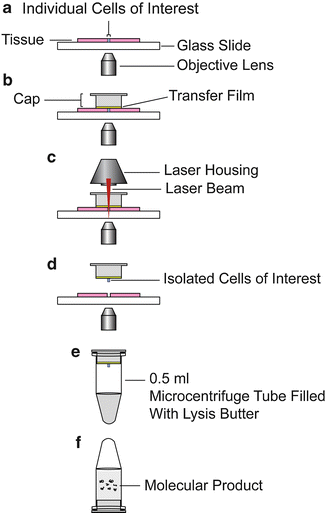 Laser Capture Microdissection in Molecular Diagnostics | SpringerLink