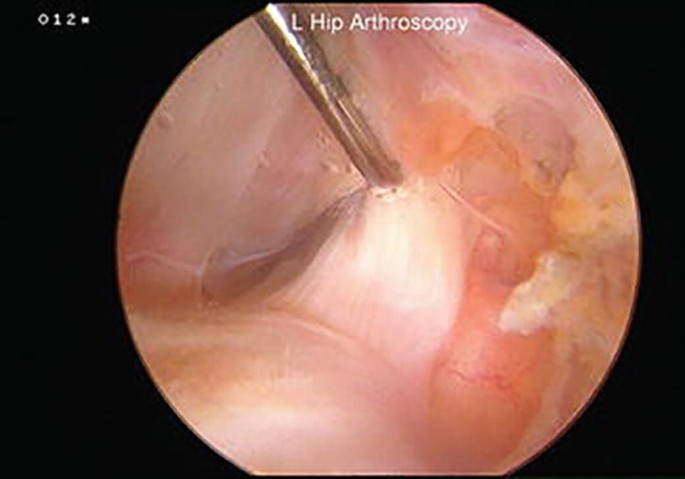 My Hip Hurts When I Sleep on My Side: Joshua D. Harris, MD: Orthopaedic  Surgery