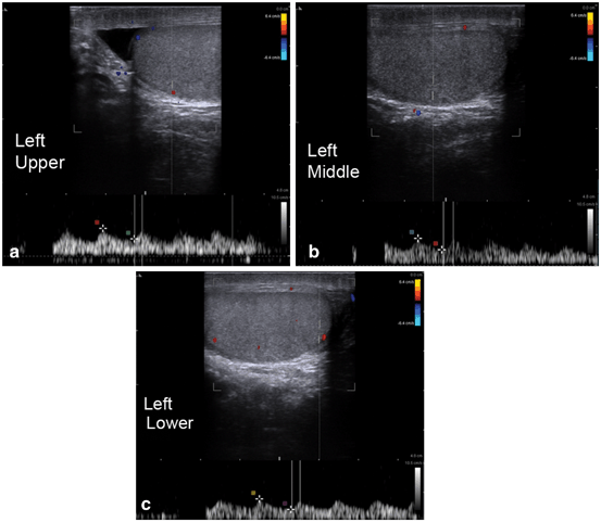 figure 16