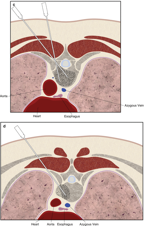 figure 002210