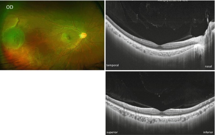 figure 16