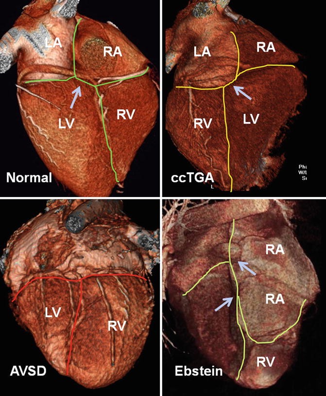 figure 20