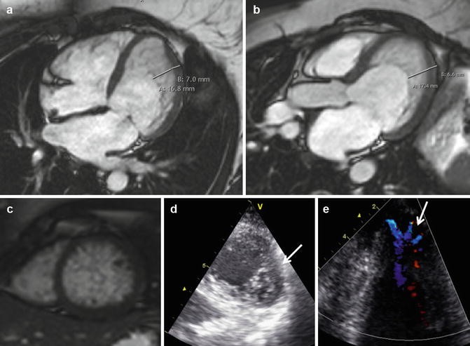 figure 23