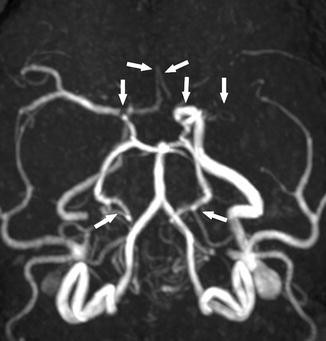 figure 16