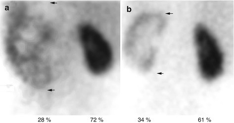 figure 25