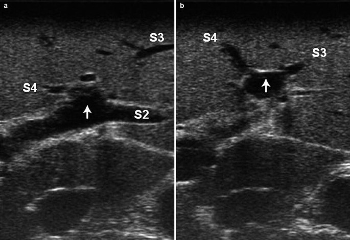 figure 25