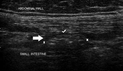 figure 33