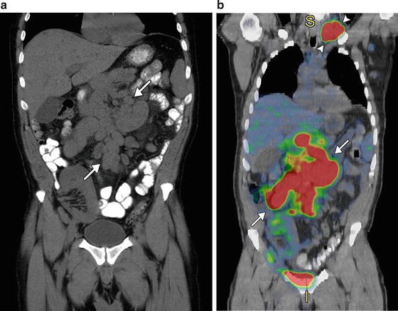 figure 23