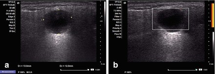 figure 17