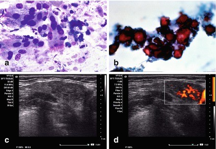 figure 21