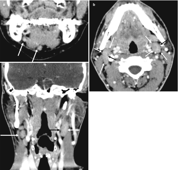 figure 21